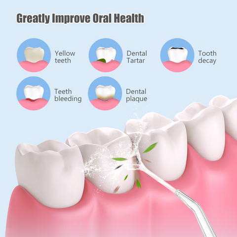 IRRIGADOR DENTAL PORTÁTIL RECARGABLE